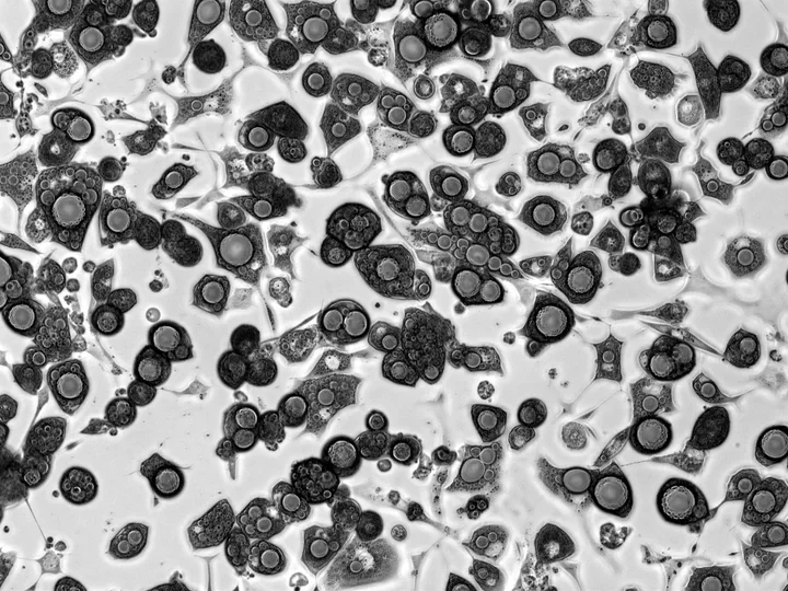 3T3-L1 cells differentiated into mature adipocytes with large lipid droplets.